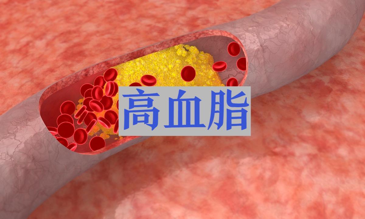 皮蛋再次成为关注对象！研究发现：高血脂吃皮蛋，身体或有6改善